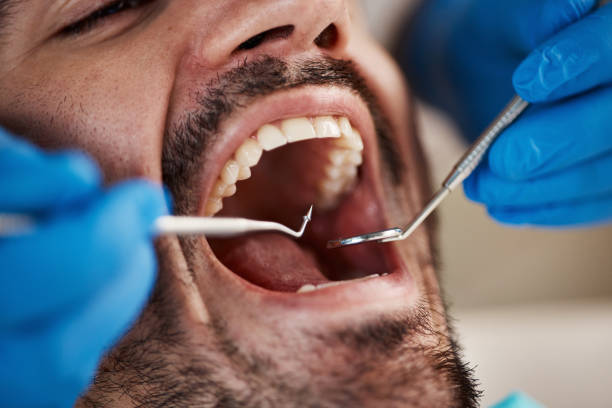 Best Emergency Dentist for Knocked-Out Tooth in Long Beach, IN